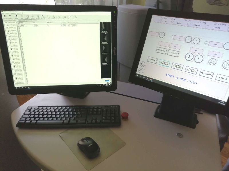 mammograf novyj kramatorsk2