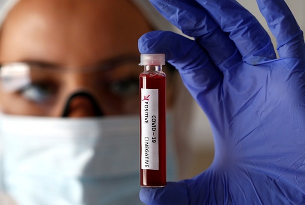 Laboratorii budut naprjamuju zakupat test sistemy dlja vyjavlenija COVID 19