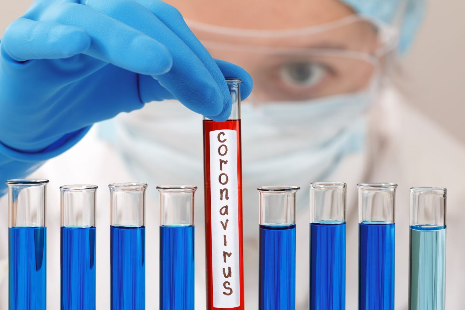 Coronavirus scaled