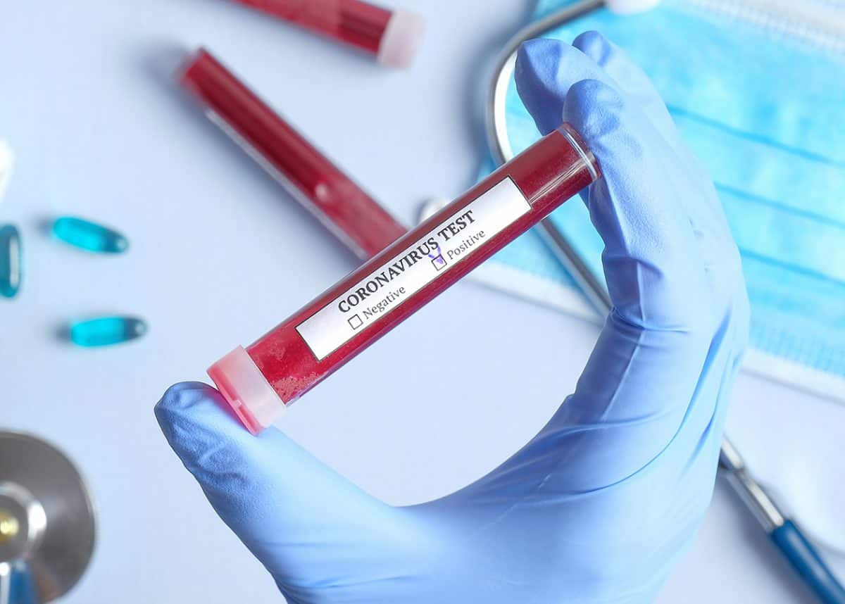 coronavirus test