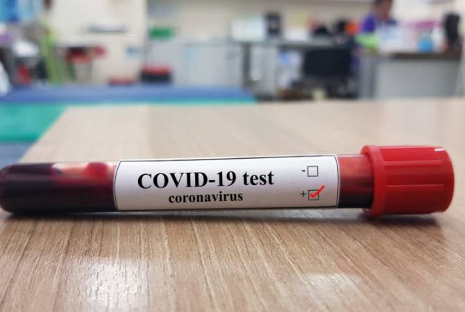 test covid