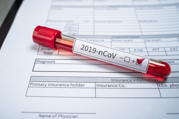 test koronavirus