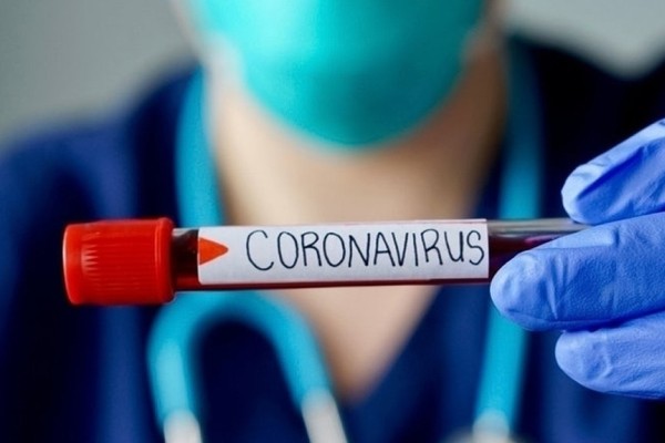 virus kovid
