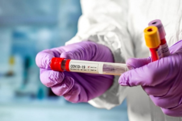 koronavirus zony