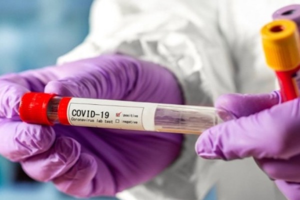 koronavirus111111