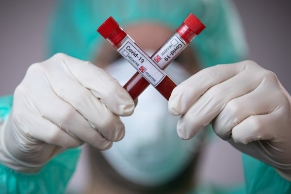 koronavirus statistika