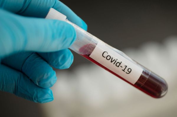 koronavirus 5