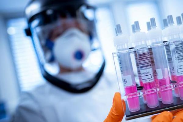 koronavirus situacija1