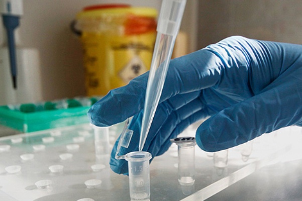 koronavirus kolichsetvo zabolevshih