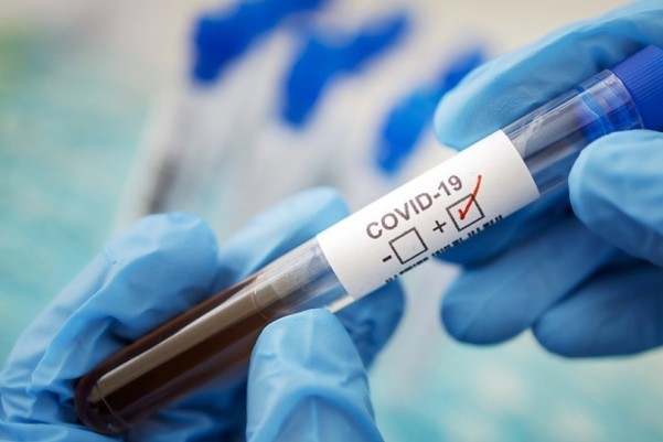 koronavirus statistika oblast gorod