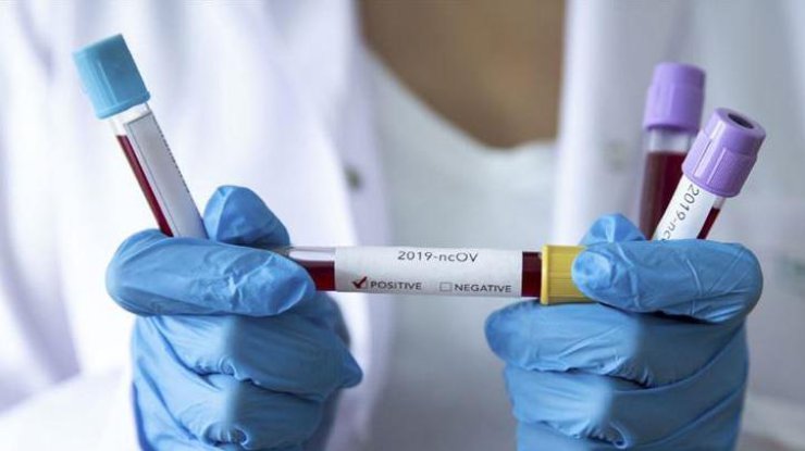 foto koronavirus aacomtr rect 41e6bd250f07e5d64b26ab2a505b7ce8