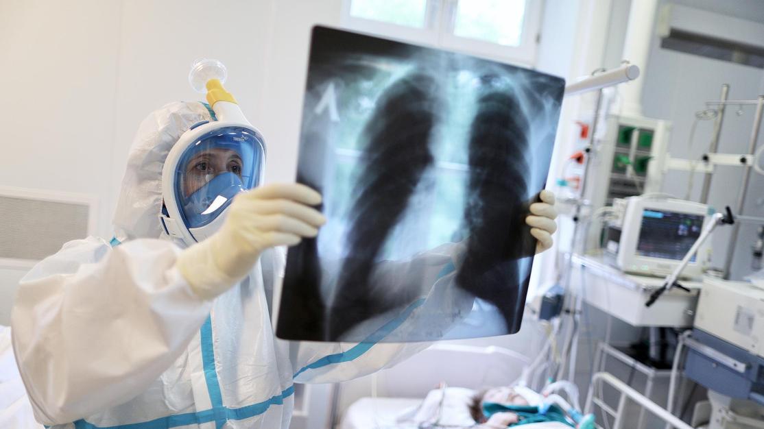 2020 05 23T202004Z 681856171 RC2KUG9NJ73K RTRMADP 3 HEALTH CORONAVIRUS RUSSIA CASES 1.JPG
