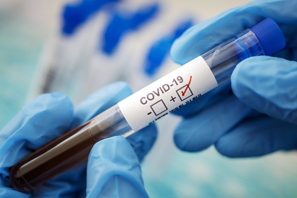 laboratorija koronavirus