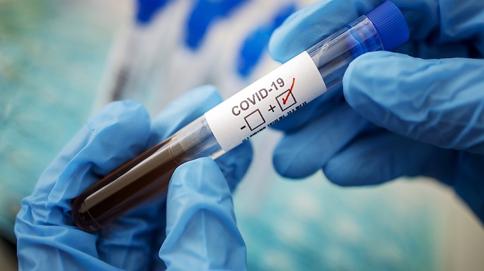 2fb4557 5e84727 koronavirus 1