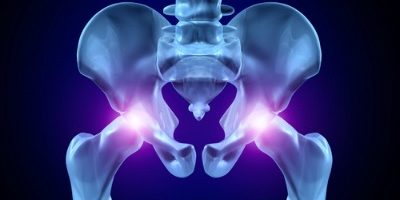 hip replacement 400.jpg.pagespeed.ic .6PfI0dk9vg 400x200